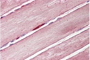 Immunohistochemistry (IHC) image for anti-Solute Carrier Family 2 (Facilitated Glucose Transporter), Member 4 (SLC2A4) (C-Term) antibody (ABIN571189)