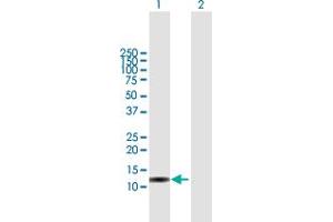 Western Blotting (WB) image for anti-ISG15 Ubiquitin-Like Modifier (ISG15) (AA 1-165) antibody (ABIN523128)