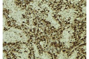 ABIN6278396 at 1/100 staining Human lung tissue by IHC-P. (RASSF2 antibody  (Internal Region))