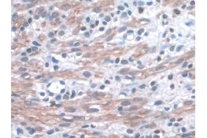IHC-P analysis of Mouse Uterus Tissue, with DAB staining. (ITGA3 antibody  (AA 33-236))
