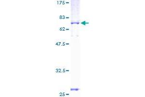 GPD2 Protein (AA 1-378) (GST tag)