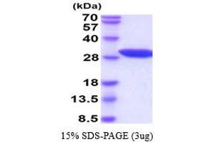 SDS-PAGE (SDS) image for Nicotinamide N-Methyltransferase (NNMT) (AA 1-264) (Active) protein (His tag) (ABIN5778252) (NNMT Protein (AA 1-264) (His tag))