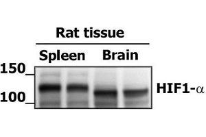 Image kindly submitted by Edita Aksamitiene as part of the Free Sample Program. (HIF1A antibody  (AA 341-450))