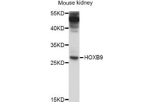 Western blot analysis of extracts of mouse kidney, using HOXB9 antibody (ABIN4903958) at 1:1000 dilution. (HOXB9 antibody)