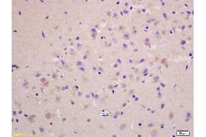 Formalin-fixed and paraffin embedded rat brain labeled with Anti-G protein alpha S Polyclonal Antibody, Unconjugated (ABIN751438) at 1:200 followed by conjugation to the secondary antibody and DAB staining. (G Protein alpha S (AA 901-1037) antibody)