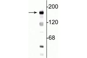 Western blot of 10  µg of rat hippocampal lysate showing specific immunolabeling of the ~180 kDa NR2B subunit of the NMDA receptor. (GRIN2B antibody  (N-Term))