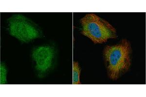ICC/IF Image Transgelin antibody detects Transgelin protein at cytoplasm and nucleus by immunofluorescent analysis. (Transgelin antibody)