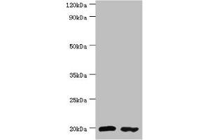 Western blot All lanes: Peptidyl-tRNA hydrolase 2, mitochondrial antibody at 4 μg/mL Lane 1: MM231 whole cell lysate Lane 2: Jurkat whole cell lysate Secondary Goat polyclonal to rabbit IgG at 1/10000 dilution Predicted band size: 19 kDa Observed band size: 19 kDa (PTRH2 antibody  (AA 40-179))