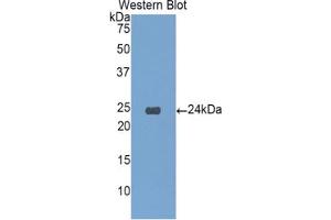 Western blot analysis of the recombinant protein. (IGFBP6 antibody  (AA 51-226))