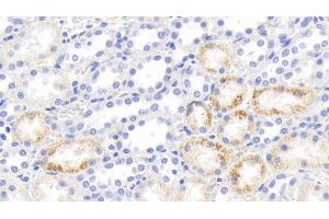 Detection of IFNg in Rabbit Kidney Tissue using Polyclonal Antibody to Interferon Gamma (IFNg) (Interferon gamma antibody  (AA 24-167))