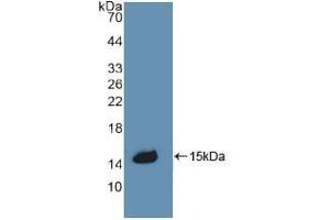 Detection of Recombinant CBG, Rat using Polyclonal Antibody to Corticosteroid Binding Globulin (CBG) (SERPINA6 antibody  (AA 267-390))
