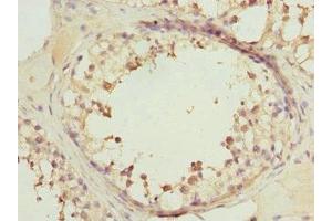 Immunohistochemistry of paraffin-embedded human testis tissue using ABIN7167216 at dilution of 1:100 (RRAS2 antibody  (AA 1-204))