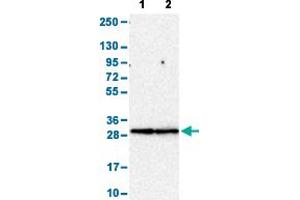 Western Blot analysis with FCGR3A polyclonal antibody . (FCGR3A antibody  (AA 227-254))