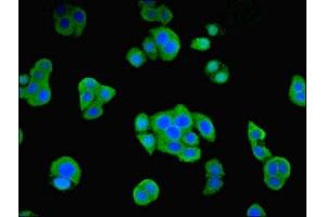 Immunofluorescent analysis of PC-3 cells using ABIN7162269 at dilution of 1:100 and Alexa Fluor 488-congugated AffiniPure Goat Anti-Rabbit IgG(H+L) (ORC4 antibody  (AA 1-436))