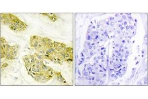 Immunohistochemistry (IHC) image for anti-Collagen, Type V, alpha 3 (COL5A3) (AA 221-270) antibody (ABIN2889917) (COL5A3 antibody  (AA 221-270))