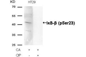 Western blot analysis of extracts from HT29 cells, treated with CA or calf intestinal phosphatase (CIP), using IκB-β (Phospho-Ser23) Antibody. (NFKBIB antibody  (pSer23))