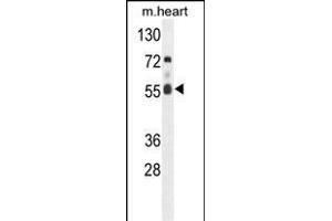 Western blot analysis of hFASTK- (ABIN391120 and ABIN2841247) in mouse heart tissue lysates (35 μg/lane). (FASTK antibody  (C-Term))