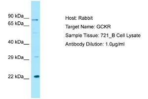 Host: RabbitTarget Name: GCKRAntibody Dilution: 1.