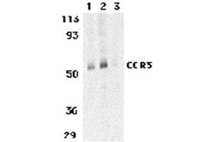 Western blot analysis of CCR3 in human spleen tissue lysates with AP30215PU-N CCR3 antibody at 1 (lane 1) and 2 μg/ml (lane 2), and 2 μg/ml in the presence of blocking peptide (lane 3). (CCR3 antibody  (C-Term))