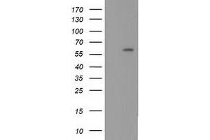 HEK293T cells were transfected with the pCMV6-ENTRY control (Left lane) or pCMV6-ENTRY CYP1A2 (Right lane) cDNA for 48 hrs and lysed. (CYP1A2 antibody)