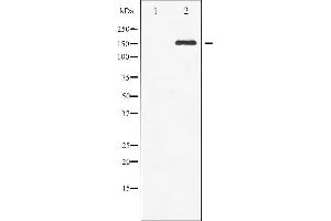 Western blot analysis of c-Met phosphorylation expression in HepG2 whole cell lysates,The lane on the left is treated with the antigen-specific peptide. (c-MET antibody  (pTyr1003))