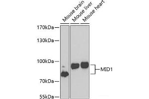 Western blot analysis of extracts of various cell lines using MID1 Polyclonal Antibody at dilution of 1:1000. (MID1 antibody)