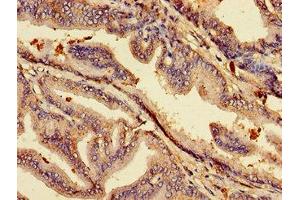 Immunohistochemistry of paraffin-embedded human prostate tissue using ABIN7158740 at dilution of 1:100