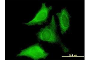 Immunofluorescence of purified MaxPab antibody to PROK1 on HeLa cell. (Prokineticin 1 antibody  (AA 1-105))