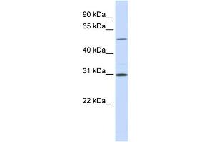 WB Suggested Anti-NEK3 Antibody Titration:  0.