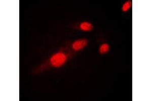 Immunofluorescent analysis of NF-kappaB p65 (AcK310) staining in HeLa cells. (NF-kB p65 antibody  (acLys310))