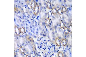 Immunohistochemistry of paraffin-embedded mouse kidney using MATK antibody (ABIN5974003) at dilution of 1/100 (40x lens).