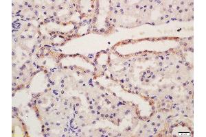 Formalin-fixed and paraffin embedded rat kidney tissue labeled with Rabbit Anti-NALP6 Polyclonal Antibody, Unconjugated (ABIN2559652) at 1:200 followed by conjugation to the secondary antibody and DAB staining (NLRP6 antibody  (AA 351-450))