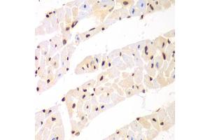 Immunohistochemistry of paraffin-embedded mouse heart using Nono Antibody (ABIN5973035) at dilution of 1/100 (40x lens). (NONO antibody)