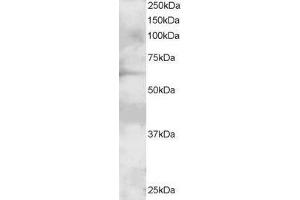 ABIN2562933 staining (2µg/ml) of A431 lysate (RIPA buffer, 30µg total protein per lane). (GRB7 antibody  (N-Term))