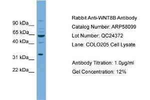 WB Suggested Anti-WNT8B  Antibody Titration: 0. (WNT8B antibody  (N-Term))