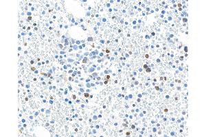 Immunohistochemistry (IHC) image for anti-Transforming Growth Factor, beta 1 (TGFB1) (AA 325-375) antibody (ABIN7449529)