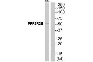 Western blot analysis of extracts from HeLa cells, using PPP2R2B antibody. (PPP2R2B antibody)