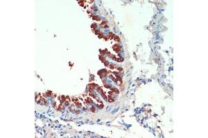 Immunohistochemistry of paraffin-embedded mouse lung using KIF5B antibody (ABIN7268136) at dilution of 1:200 (40x lens). (KIF5B antibody  (AA 650-770))