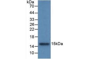 Detection of Recombinant CSTB, Rat using Monoclonal Antibody to Cystatin B (CSTB) (CSTB antibody  (AA 2-98))