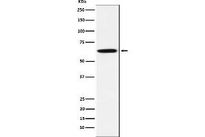 Western blot analysis of GRB7 expression in A431 cell lysate.