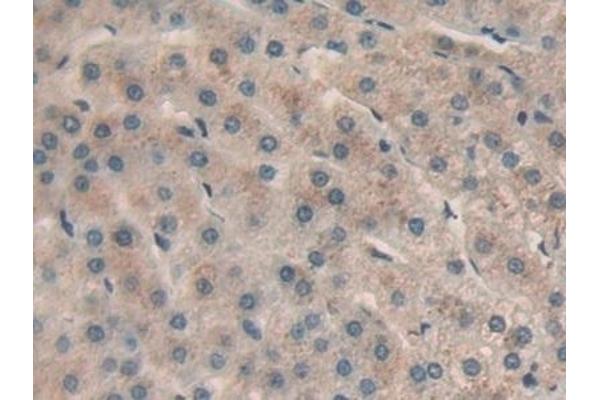 CHI3L1 antibody  (AA 112-377)