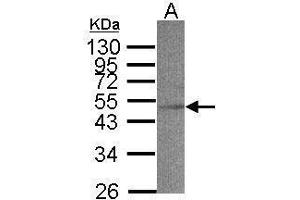 WB Image Sample(30 μg of whole cell lysate) A:MOLT4, 12% SDS PAGE antibody diluted at 1:500 (ACADS antibody  (N-Term))