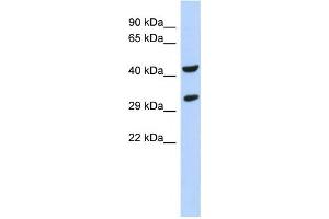 Western Blotting (WB) image for anti-Ankyrin Repeat and SOCS Box Containing 8 (ASB8) antibody (ABIN2459530) (ASB8 antibody)