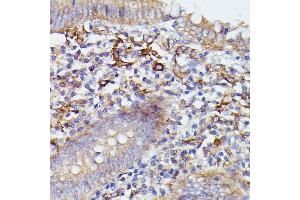 Immunohistochemistry (IHC) image for anti-Synaptosomal-Associated Protein, 23kDa (SNAP23) (AA 1-211) antibody (ABIN7270670)