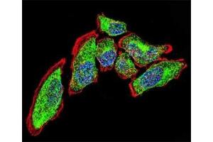 Confocal immunofluorescent analysis of Vimentin antibody with A549 cells followed by Alexa Fluor 488-conjugated goat anti-rabbit lgG (green). (Vimentin antibody)
