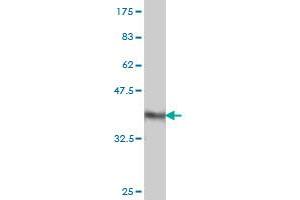 Western Blotting (WB) image for anti-Coagulation Factor XI (F11) (AA 286-385) antibody (ABIN560828)