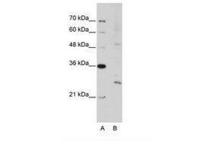 Image no. 3 for anti-Exosome Component 4 (EXOSC4) (N-Term) antibody (ABIN202117) (EXOSC4 antibody  (N-Term))