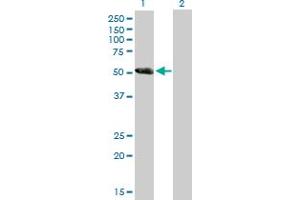 Western Blot analysis of DKFZP779L1558 expression in transfected 293T cell line by DKFZP779L1558 MaxPab polyclonal antibody. (CCDC91 antibody  (AA 1-411))