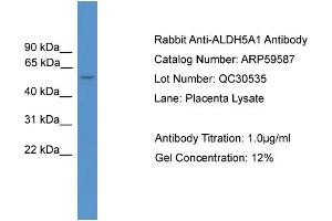 WB Suggested Anti-ALDH5A1  Antibody Titration: 0. (ALDH5A1 antibody  (Middle Region))