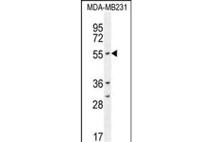 CYP2A7 Antibody (Center) (ABIN654434 and ABIN2844170) western blot analysis in MDA-M cell line lysates (35 μg/lane). (CYP2A7 antibody  (AA 121-148))